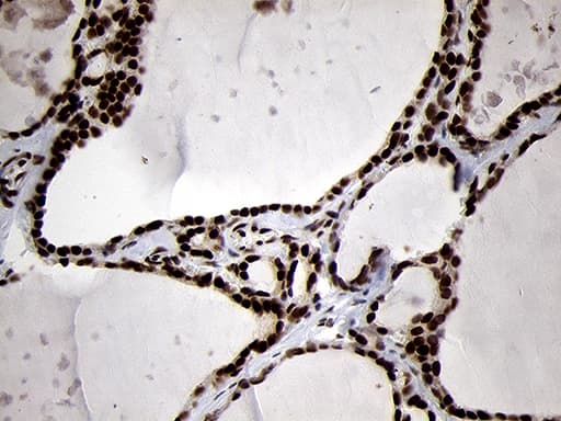 SMC1A / SMC1 Antibody (aa889-1016, clone OTI3G4, Carrier-free)