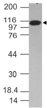 TLR6 Antibody (Azide-free)