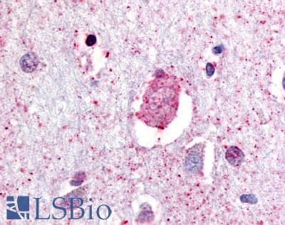 IHC-plus™ Polyclonal Rabbit anti-Human GPR88 Antibody (C-Terminus, IHC)