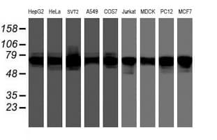 IHC-plus™ FMR1 / FMRP Antibody (clone 1D10)