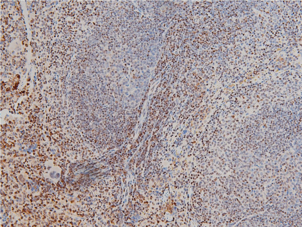 CFL1 / Cofilin Antibody (phospho-Ser3)