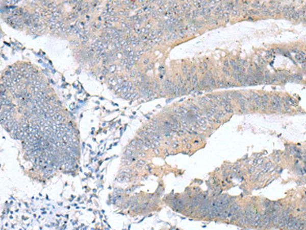 KRCC1 Antibody