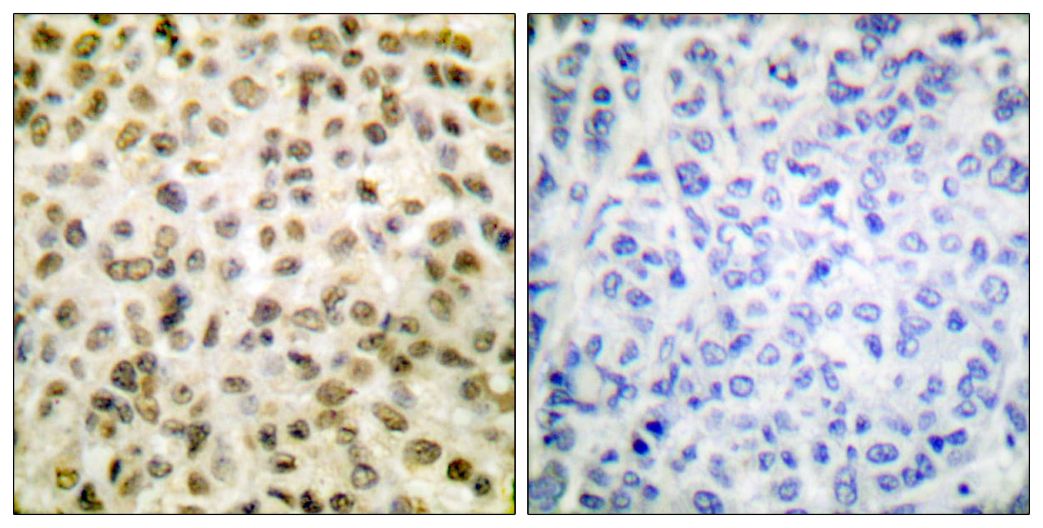Histone H1 Antibody (Acetyl-Lys25)