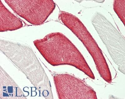 IHC-plus™ Polyclonal Rabbit anti-Human PRKAA1 / AMPK Alpha 1 Antibody (aa350-400, IHC, WB)