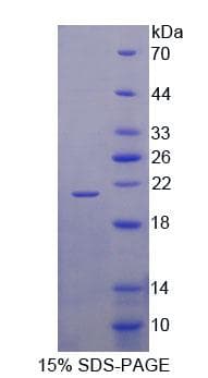 Human SLC1A6 / EAAT4 Protein (Recombinant His-T7)