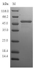 Human CHMP2B Protein (Recombinant GST, N-terminus)