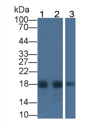 ACP1 / Acid Phosphatase Antibody (aa1-158)