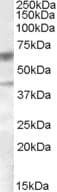 IHC-plus™ DGAT2 Antibody (aa303-316)