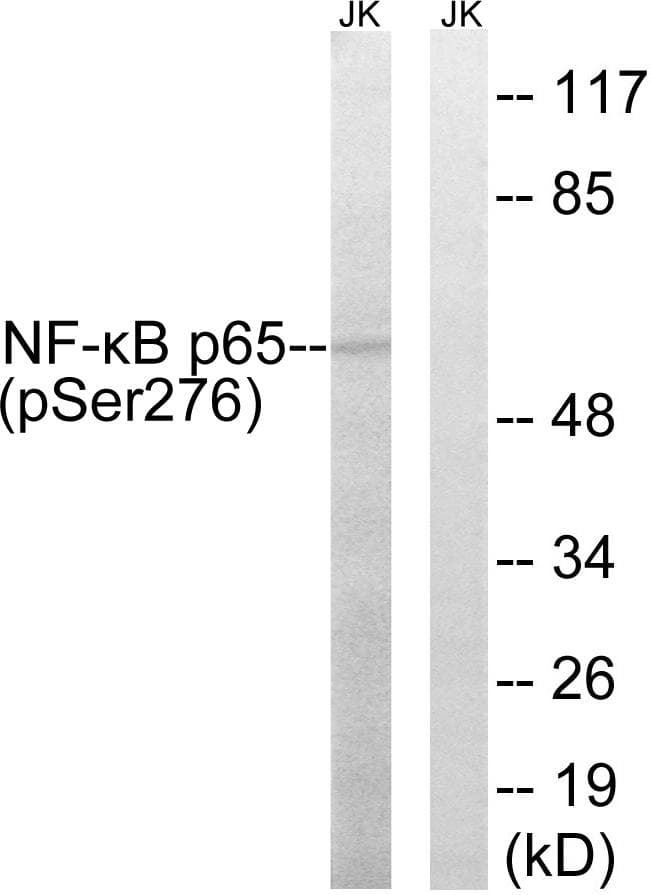 RELA / NFKB p65 Antibody (phospho-Ser276)