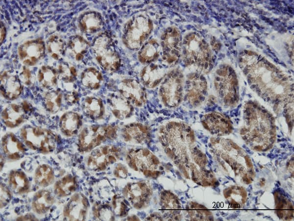 PRKAR1B Antibody (clone 1F8)