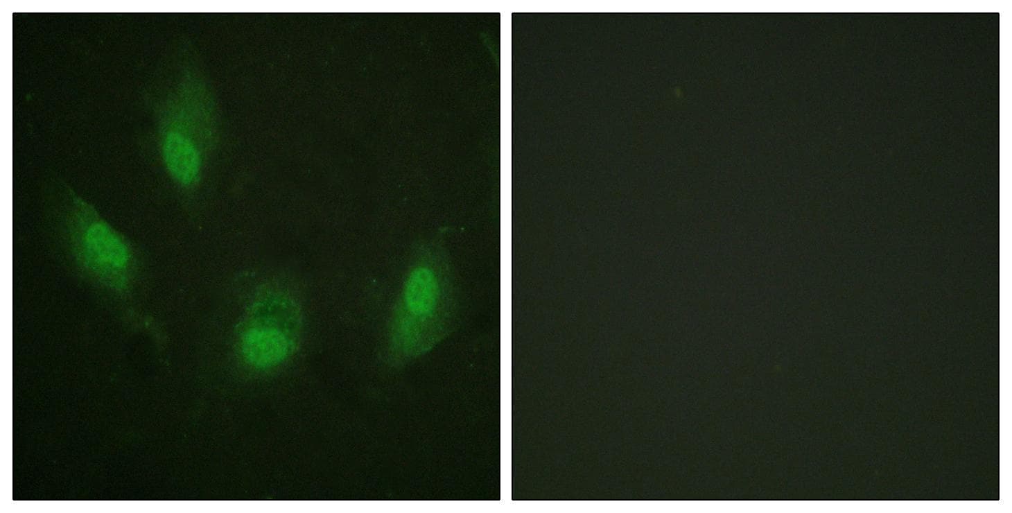 Polyclonal Rabbit anti-Human TP53 / p53 Antibody (p392, IHC, IF, WB)