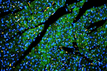 CAV3 / Caveolin 3 Antibody