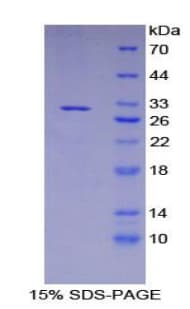Human APBA3 / MINT3 Protein (Recombinant His, N-Terminal)