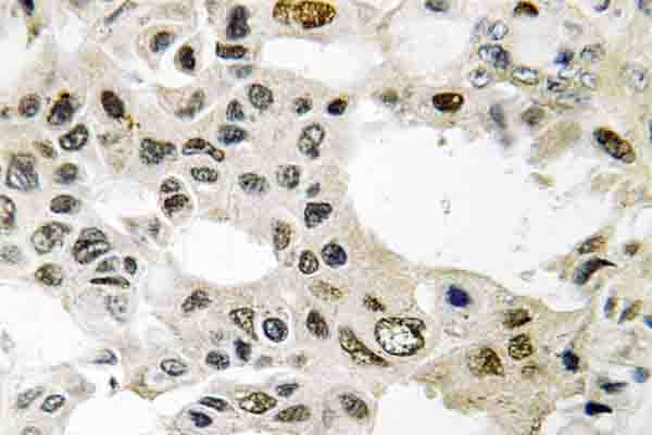 Polyclonal Rabbit anti-Human EIF3D Antibody (Arg135, IHC, WB)
