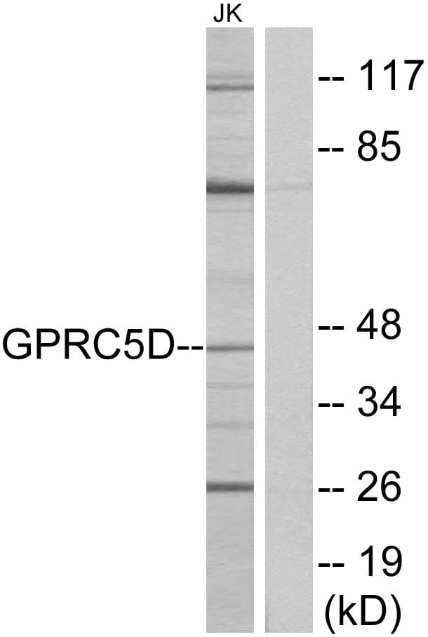 GPRC5D Antibody (aa271-320)