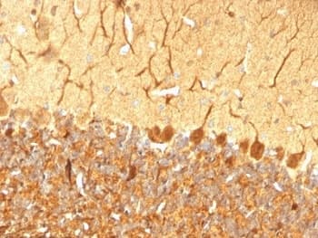 UCHL1 / PGP9.5 Antibody (clone SPM574)