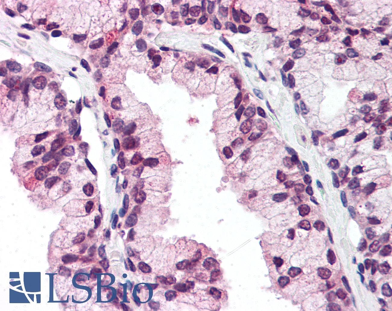 IHC-plus™ DDX3 / DDX3X Antibody