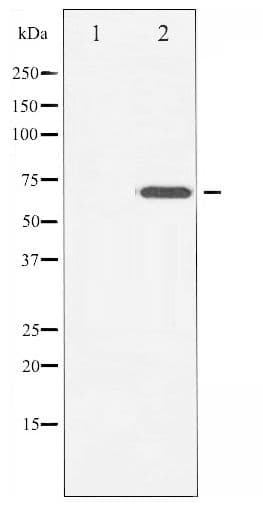 ZAP70 Antibody (phospho-Tyr493)