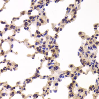 Polyclonal Rabbit anti-Human PYGL Antibody (IHC, IF, WB)