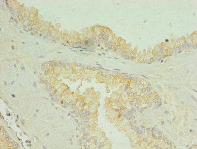 SLC34A2 / NaPi-2b Antibody