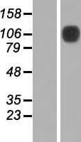 NEP / DDR1 Protein (Over-Expression Lysate Myc-DDK (Flag))