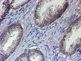 Monoclonal Mouse anti-Human ERBB2 / HER2 Antibody (clone OTI12G4, Carrier-free, aa676-1255, IHC, IF, WB)