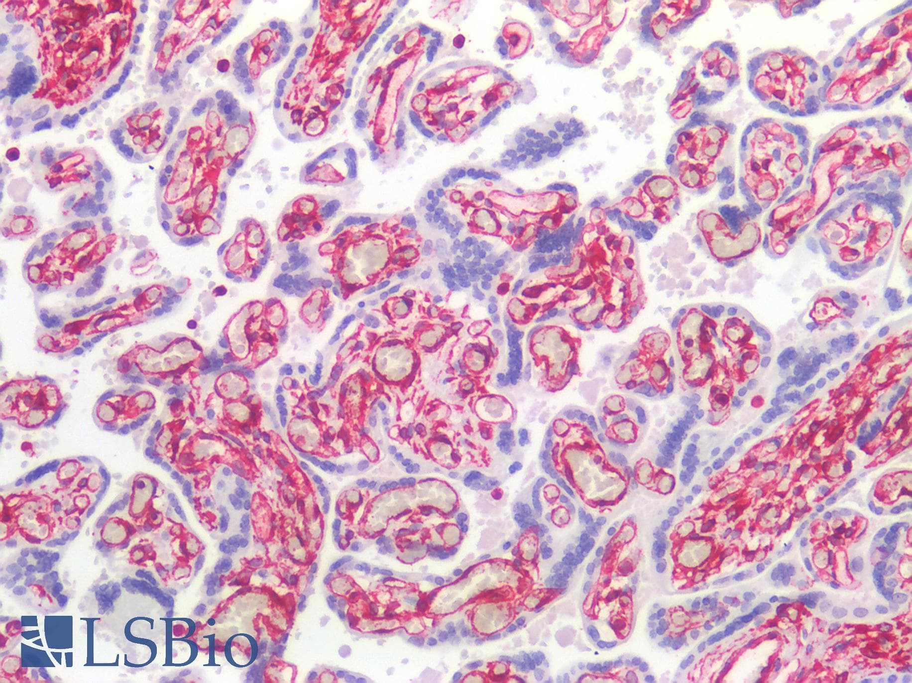 PathPlus™ Vimentin Antibody