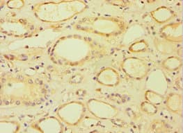 Polyclonal Rabbit anti-Human BRCC3 / BRCC36 Antibody (aa1-316, IHC, WB)