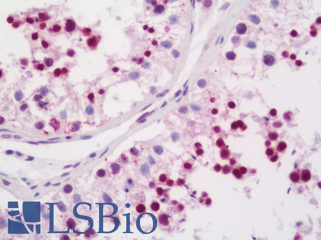 IHC-plus™ LYAR Antibody (aa241-290)