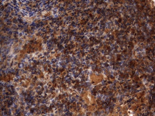 Monoclonal Mouse anti-Human HMBS / PBGD Antibody (clone UMAB144, Carrier-free, IHC, IF, WB)