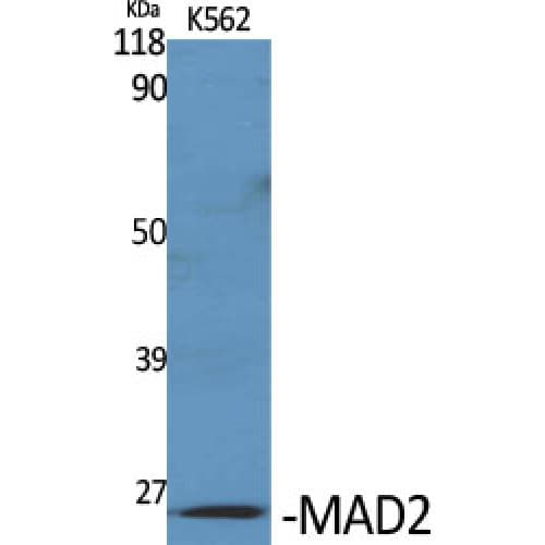 Polyclonal Rabbit anti-Human MAD2L1 / MAD2 Antibody (60-140 aa, Internal, WB)