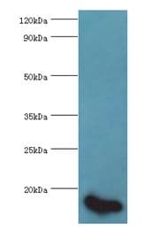 E-FABP / FABP5 Antibody (aa1-135)