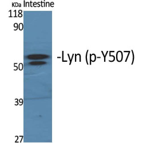 Polyclonal Rabbit anti-Human LYN Antibody (phospho-Tyr508, IHC, WB)