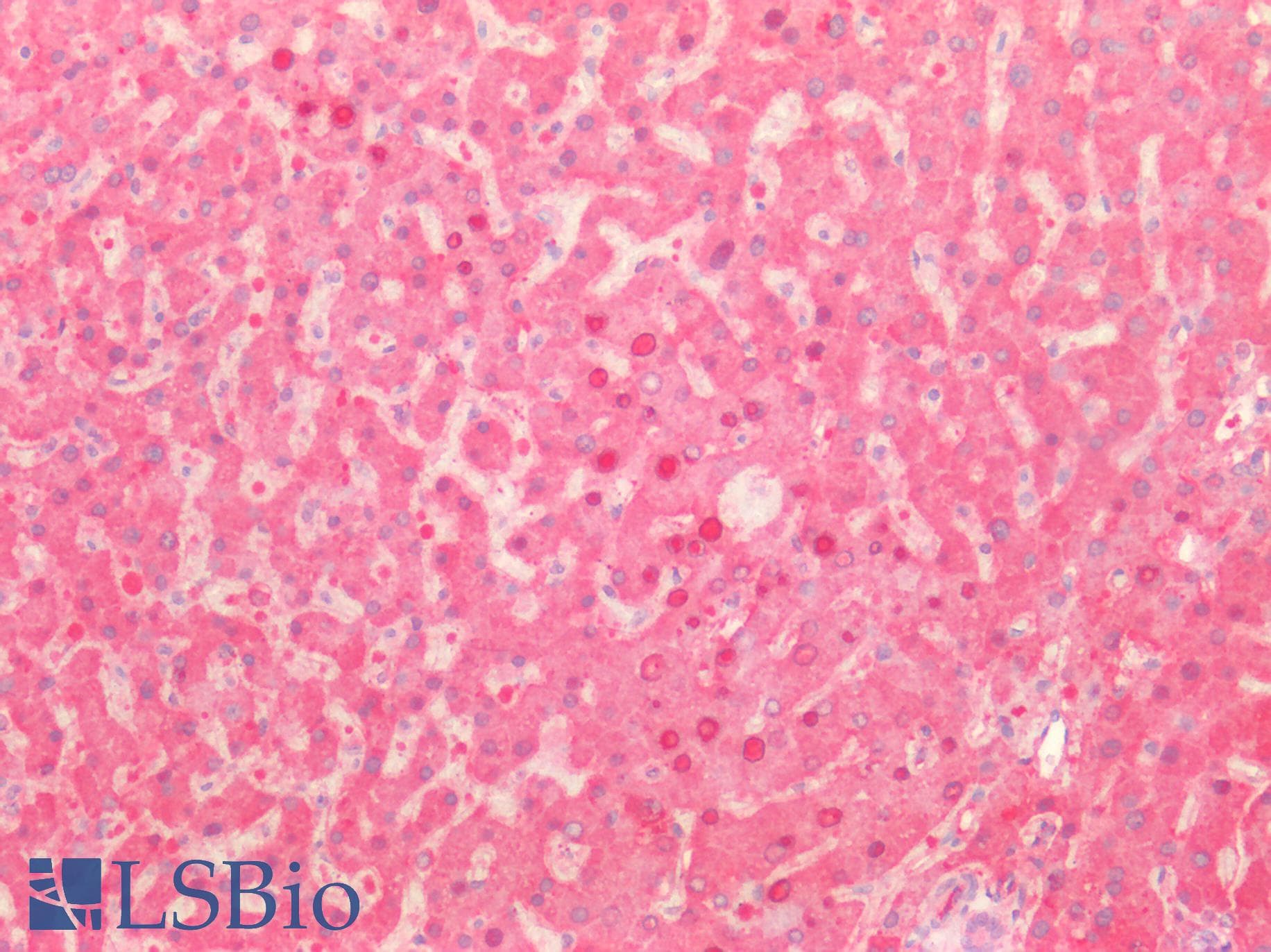 Antithrombin Antibody (aa33-464)