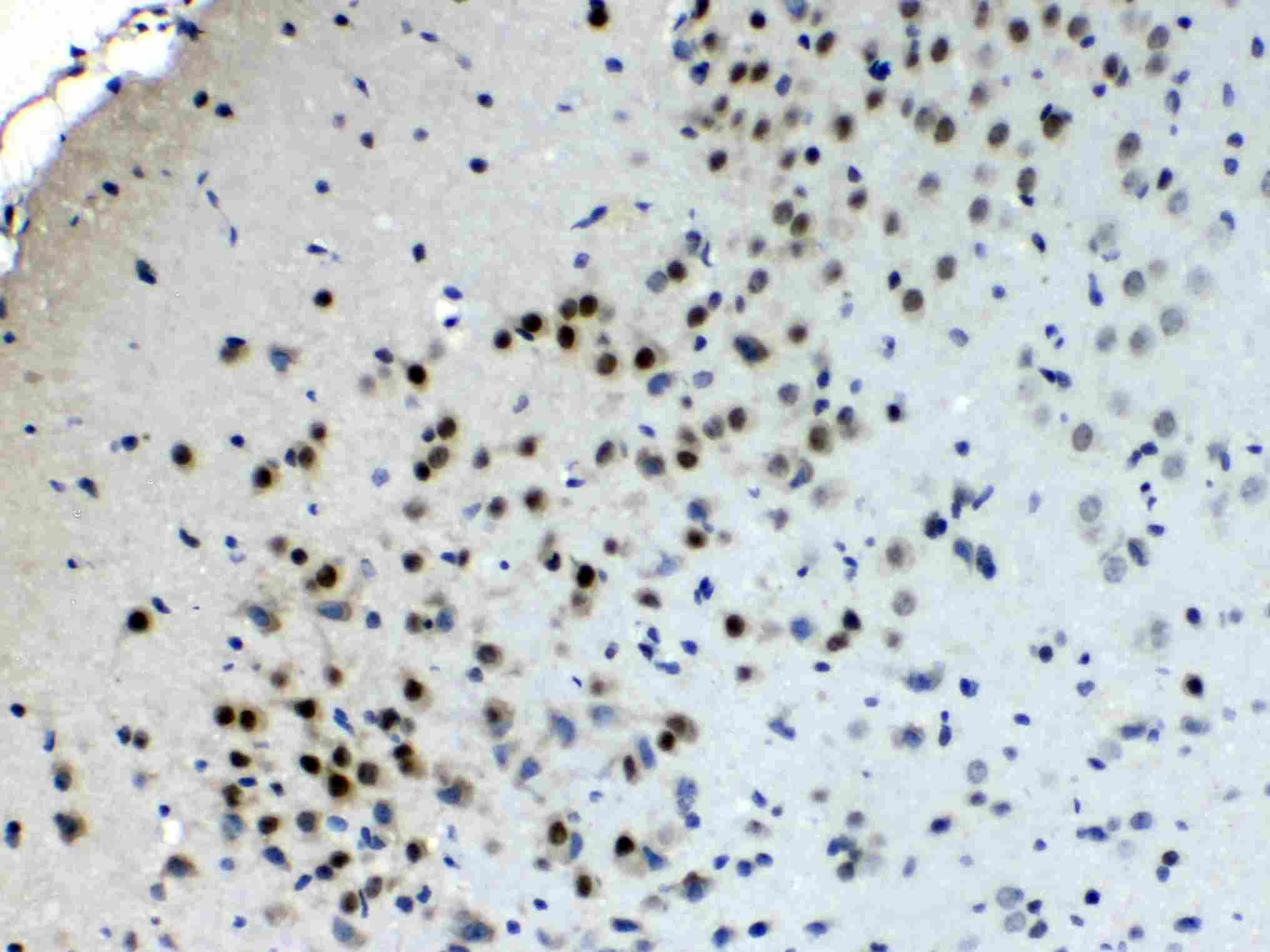 Polyclonal Rabbit anti-Human CHAT Antibody (IHC, WB)