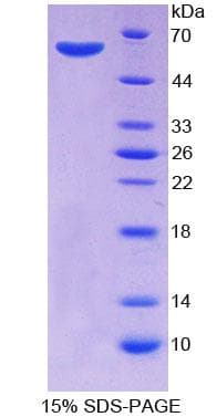 Human GTF2A1 / TFIIA Protein (Recombinant His-GST)