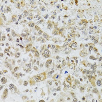 DMAP1 Antibody (AP)