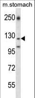 LAMC2 / Laminin Gamma 2 Antibody (aa941-970)