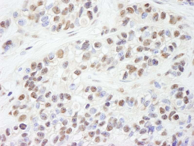 XPA Antibody (aa1-50)