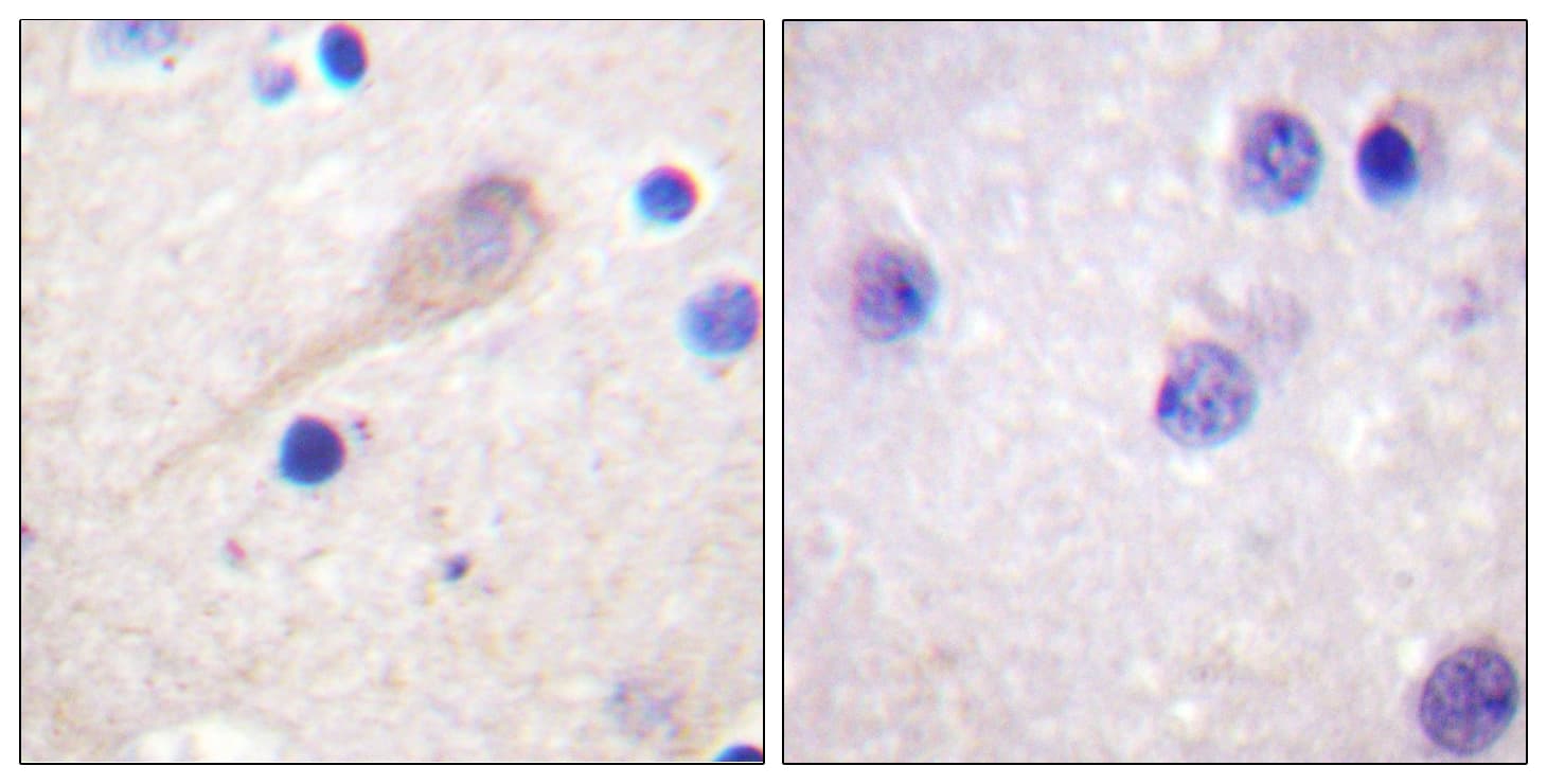 PARK2 / Parkin 2 Antibody (aa101-150)