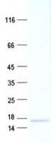 Human ADAMTSL1 Protein (Recombinant His, N-Terminal)