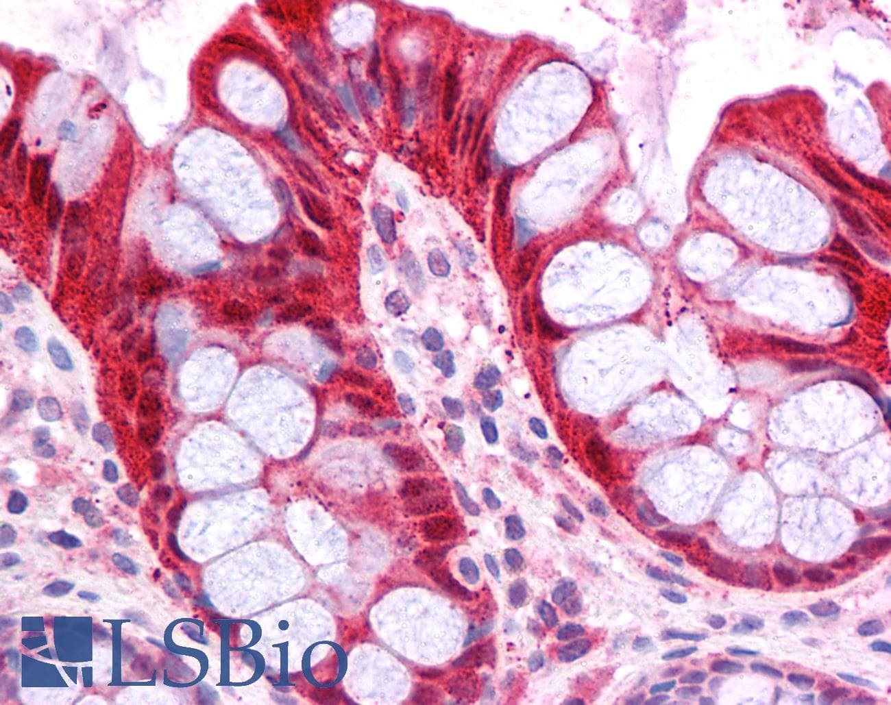 FABP1 / L-FABP Antibody (N-Terminus)