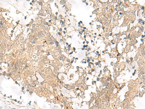 GPSM1 / AGS3 Antibody