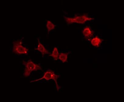 Polyclonal Rabbit anti-Human ADCK2 Antibody (IF, WB)