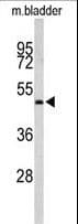 ACTR3B / ARP4 Antibody (aa325-352)