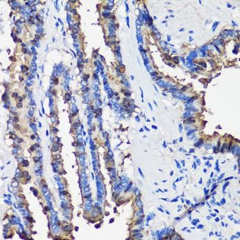 SCGB1A1 / Uteroglobin Antibody
