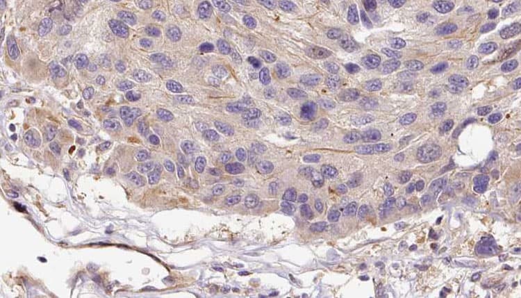 SERPINF2 / Alpha-2-Antiplasmin Antibody