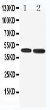 Polyclonal Rabbit anti-Human HTR1A / 5-HT1A Receptor Antibody (aa404-422, IHC, WB)