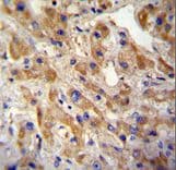 Monoclonal Mouse anti-Human c-Met Antibody (clone 6AT203, IHC, IF, WB)