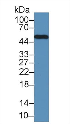 LSP1 Antibody (aa126-330, HRP)